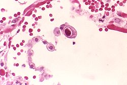 Cytomegalovirus (Strain: AD-169)